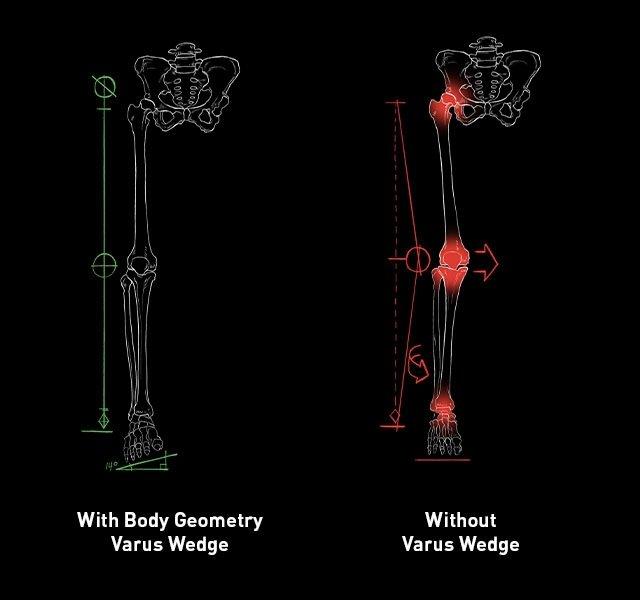Varus Wedge