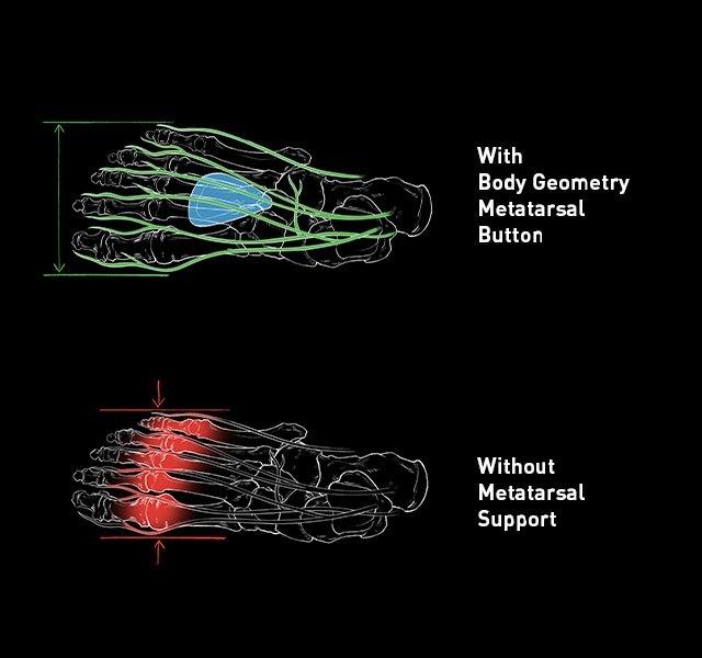 Botón Metatarsal